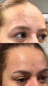 Eyebrow Tattoo result by La Belle Esthetic & Spa in Rye, NY