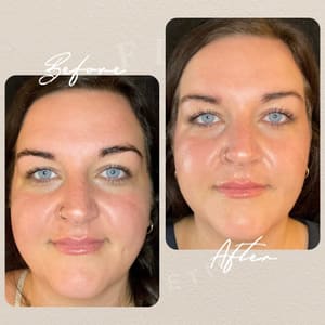 Eyebrow Tattoo result by La Fleur Aesthetics in Holly Springs, NC