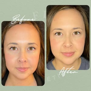 Eyebrow Tattoo result by La Fleur Aesthetics in Holly Springs, NC