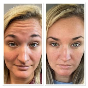 Eyebrow Tattoo result by La Medspa in Montgomery, AL