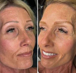 Eyebrow Tattoo result by LAB Esthetics Bar, inside The Lash Gallery in Murrieta, CA