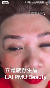 Eyebrow Tattoo result by Lai PMU Beauty /Eyebrows Tattoo/Nona Brows/ Eyebrows Removal/ Stretch Marks inkless in Arcadia, CA