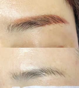 Eyebrow Tattoo result by Lai PMU Beauty /Eyebrows Tattoo/Nona Brows/ Eyebrows Removal/ Stretch Marks inkless in Arcadia, CA
