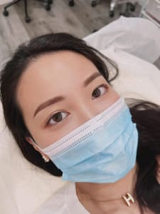 Eyebrow Tattoo result by Lai PMU Beauty /Eyebrows Tattoo/Nona Brows/ Eyebrows Removal/ Stretch Marks inkless in Arcadia, CA