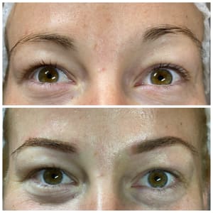 Eyebrow Tattoo result by Laser Center Of Melbourne in Melbourne, FL