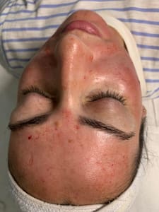 Eyebrow Tattoo result by Laser Spa Studio in Long Beach, NY