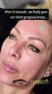 Eyebrow Tattoo result by Laser Spa Studio in Long Beach, NY