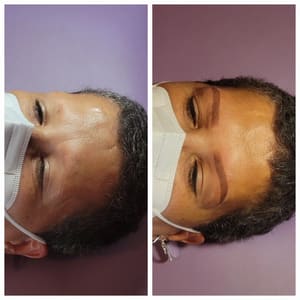 Eyebrow Tattoo result by Lash And Brow Bar by Mali in Staten Island, NY