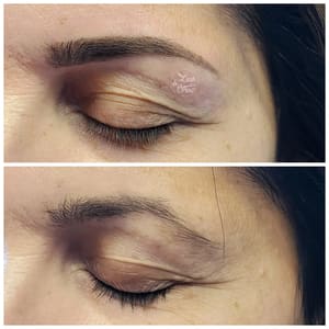 Eyebrow Tattoo result by Lash & Brow by Chris in Westwood, NJ