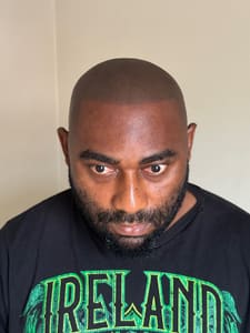 Eyebrow Tattoo result by Lasting Impressions SMP in Bristol, PA