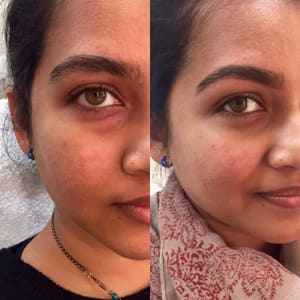 Eyebrow Tattoo result by Laturca Beauty and Skin Care in West Hollywood, CA