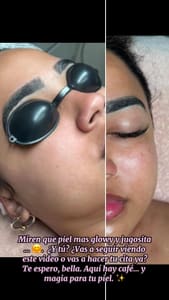 Eyebrow Tattoo result by Le Skin Med Spa in Springfield, MA