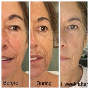 Eyebrow Tattoo result by Legacy 41 in Sea Girt, NJ