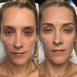 Eyebrow Tattoo result by Lilac Lash And Beauty in Columbia, MD