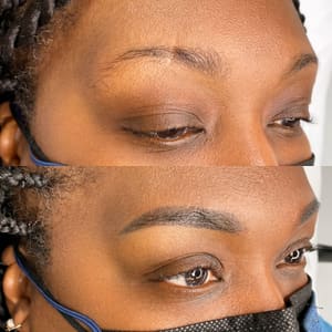 Eyebrow Tattoo result by Lip Filler by SkinDose in Kew Gardens, NY