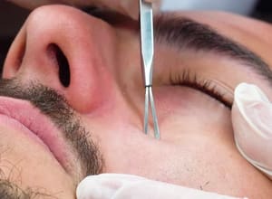 Eyebrow Tattoo result by Liz Skincare in Miami, FL