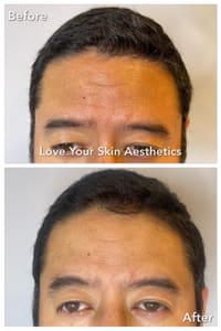 Eyebrow Tattoo result by Love Your Skin Aesthetics in Artesia, CA