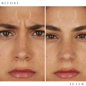 Eyebrow Tattoo result by Lumiere Pure Body Med Spa in Moorestown, NJ