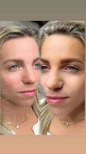 Eyebrow Tattoo result by Lunabella permanent makeup in Paramus, NJ