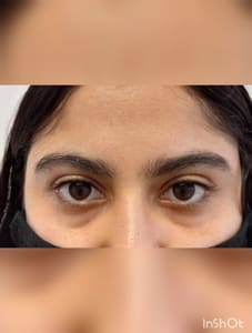 Eyebrow Tattoo result by Luxury Brows N&J in Elizabeth, NJ