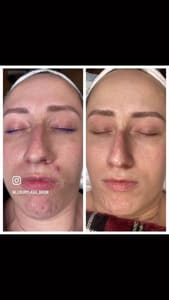 Eyebrow Tattoo result by Luxury Lash & Brow, LLC in Waukesha, WI