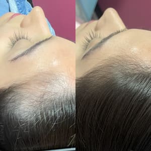 Eyebrow Tattoo result by Magnolia Electrolysis & Aesthetics in Nutley, NJ