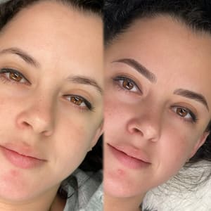Eyebrow Tattoo result by Mara Beauty and Brows in Cutler Bay, FL