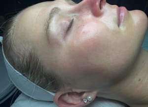 Eyebrow Tattoo result by Marilene's Day Spa in Somerville, MA