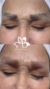 Eyebrow Tattoo result by MB Advanced Med Spa & Beauty in Sunny Isles Beach, FL