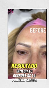 Eyebrow Tattoo result by MB Advanced Med Spa & Beauty in Sunny Isles Beach, FL