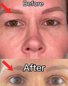 Eyebrow Tattoo result by MD Beauty Labs in Palm Beach, FL