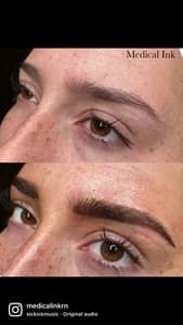 Eyebrow Tattoo result by Medical Ink in Baton Rouge, LA