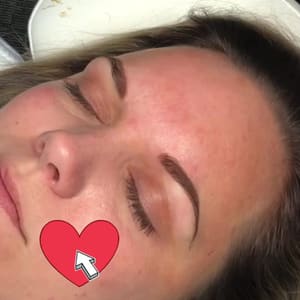 Eyebrow Tattoo result by Medical Ink in Baton Rouge, LA