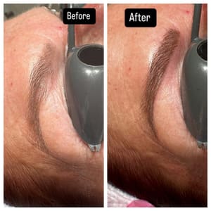 Eyebrow Tattoo result by Medical skincare with Airrisa Nuccio LLC in Vero Beach, FL