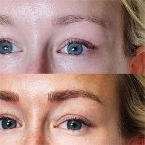 Eyebrow Tattoo result by Megan Danielle Skincare,LLC in Carmel, IN