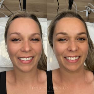 Eyebrow Tattoo result by mei aesthetics co. in Rochester Hills, MI