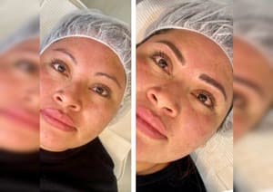 Eyebrow Tattoo result by Melania Kand Aesthetics in Fresh Meadows, NY