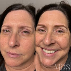 Eyebrow Tattoo result by Michel Design Studio | Microblading in Macon, GA