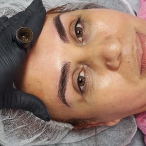 Eyebrow Tattoo result by Micro Capillary Solution in Miami, FL