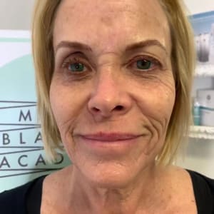 Eyebrow Tattoo result by Microblading Academy Inc in Ventura, CA