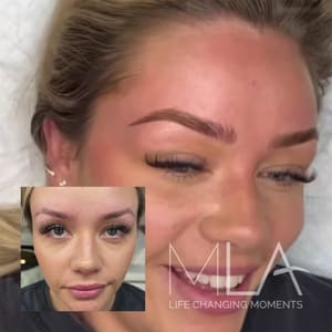 Eyebrow Tattoo result by Microblading LA in Woodland Hills, CA