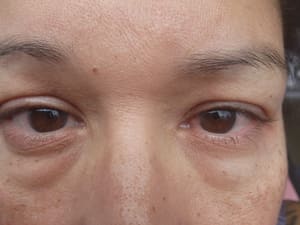 Eyebrow Tattoo result by Miji Lash Duarte in Duarte, CA