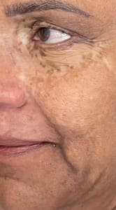 Eyebrow Tattoo result by Mirinka Permanent Cosmetic Centers. Specialist in Cosmetic Tattooing and ParaMedical Tattooing in Fort Lauderdale, FL