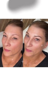 Eyebrow Tattoo result by Modern Beauty Studios NJ in Watchung, NJ