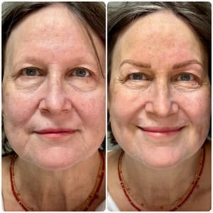 Eyebrow Tattoo result by Mojo Master Beauty Rehab in Stuart, FL