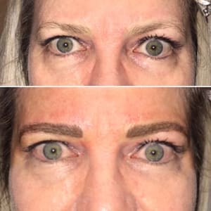 Eyebrow Tattoo result by MPI Clinic in La Mesa, CA