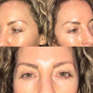 Eyebrow Tattoo result by MPI Clinic in La Mesa, CA