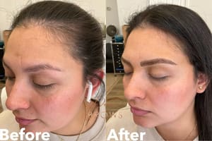 Eyebrow Tattoo result by Nanoblading Brows & PMU Magnetic Removal in Valley Village, CA