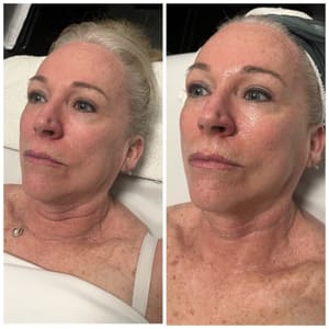 Eyebrow Tattoo result by Natural Beauty Esthetics in Tyler, TX
