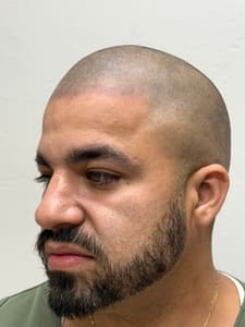 Eyebrow Tattoo result by Natural Effect (Scalp Micropigmentation OKC) in Oklahoma City, OK